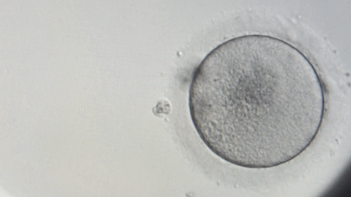 Embryo time lapse